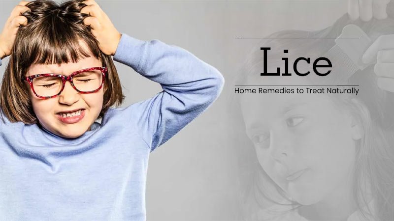 Lice Treatment: 5 Home Remedies to Treat Naturally